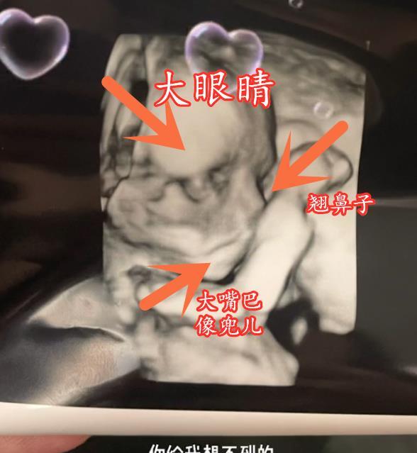 小猪先生兜儿晒孩子四维图,大眼睛高鼻梁大嘴巴,比妹
