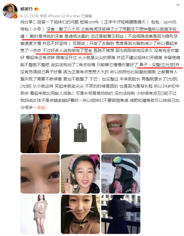 都美竹承认整容做了双眼皮和箍牙旧照被指像38岁