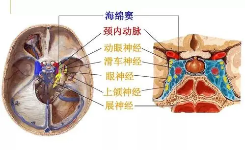 上眼皮下垂,本文让你轻松掌握动眼神经麻痹的常见病因