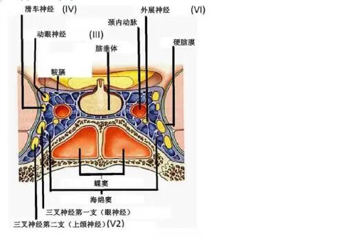 上眼皮下垂,本文让你轻松掌握动眼神经麻痹的常见病因