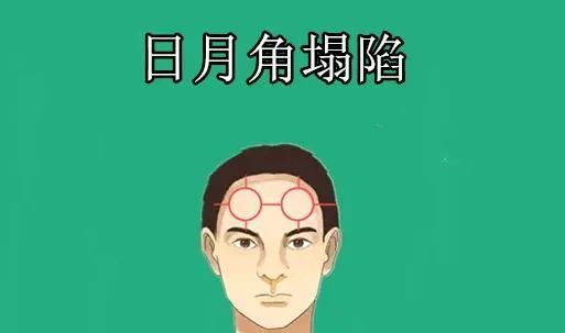 三,日月角和将军骨
