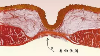 其实,肚脐眼它就是个伤口愈合后的疤啊!根本没有连着肠道.