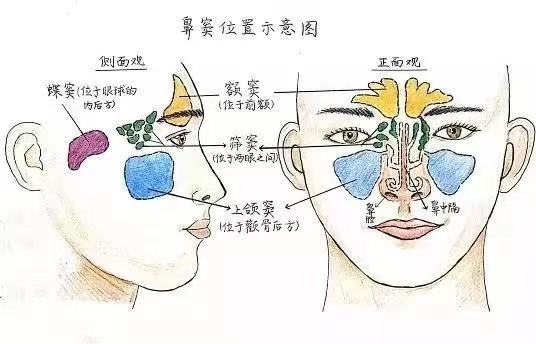 孩子鼻塞,流脓涕,咳嗽,或许不是"感冒",都是鼻窦炎惹的祸