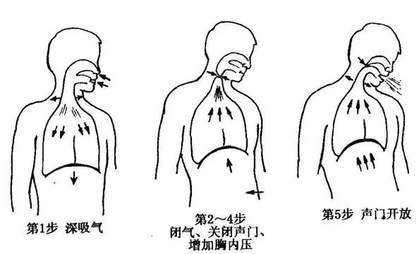 慢阻肺患者痰"排不净"后果会很严重,这"四字诀"是排痰关键!