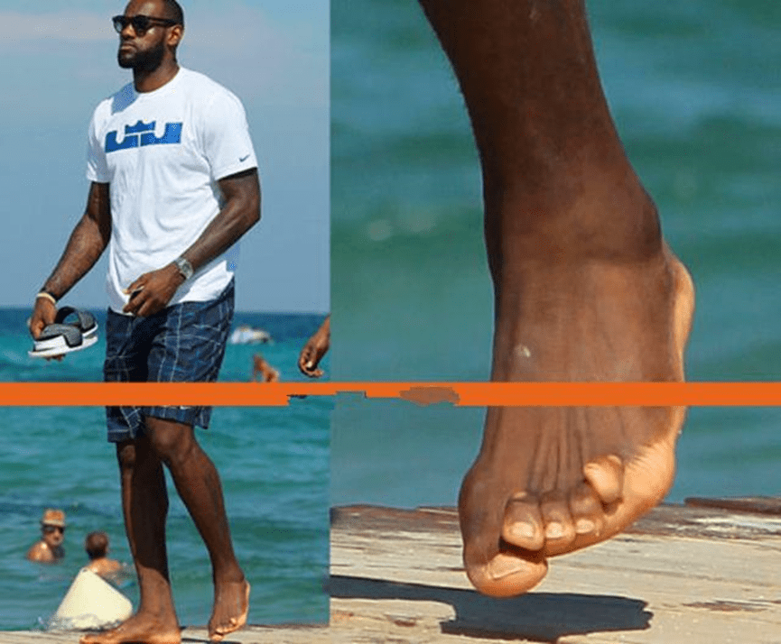 nba NBA球员赚上千万很容易？看这些照片就明白，球神詹姆斯脚趾变形