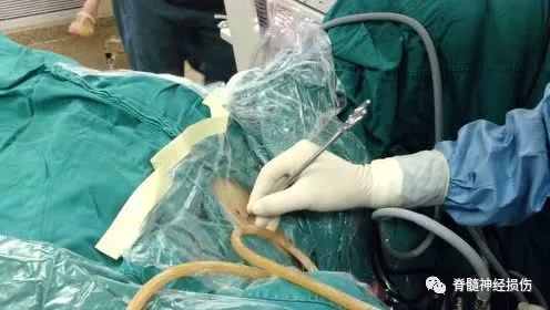 如何护理脊髓神经损伤患者?