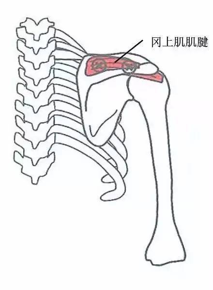 7,冈上肌,斜方肌上部压痛区
