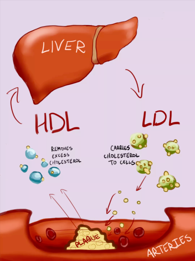 而 高密度脂蛋白通常被称为 "好的"胆固醇(hdl),hdl是保护你的心脏的.