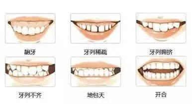 人口中有多少牙齿_外貌年龄计算器 显老OR装嫩一测便知