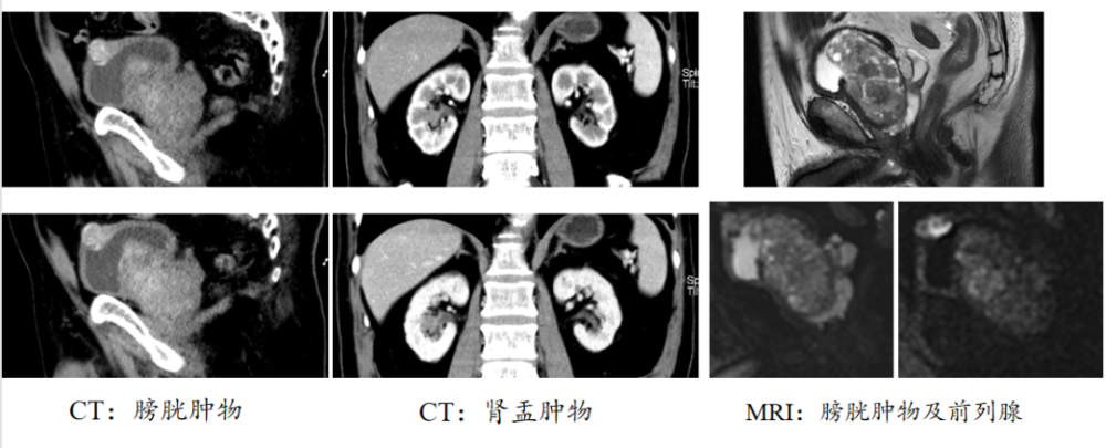 ctu是什么意思 腾讯网