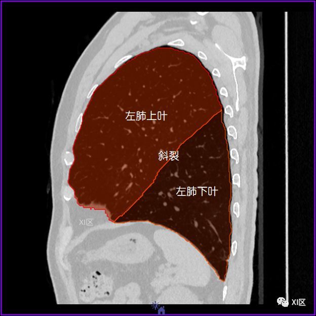 如此详细的肺部影像解剖有点儿酷