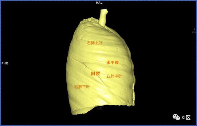 气管支气管树与两肺融合显示 肺的分叶 左肺借斜裂成上,下两叶;右肺