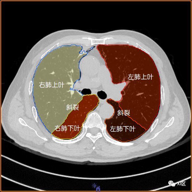与胸部骨骼的关系在日常工作中我们也经常会遇到需要定位并病灶的位置