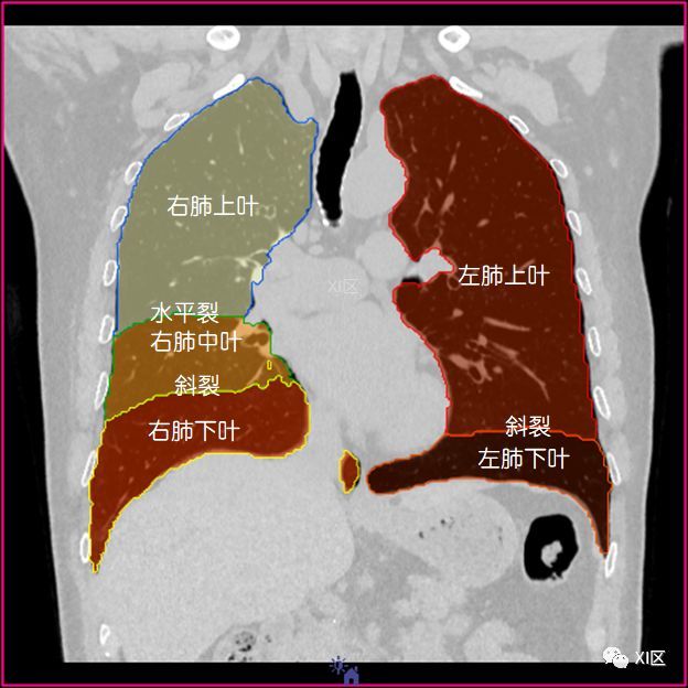 如此详细的肺部影像解剖,有点儿酷!