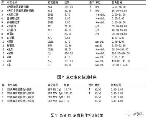 异型淋巴细胞高达14诊断却并非传染性单核细胞增多症