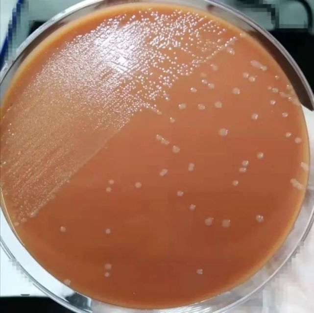 有关脑膜炎奈瑟菌的那些事儿