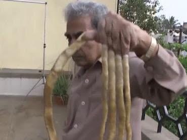 印度老人66年没剪指甲,将9米长指甲捐博物馆后,手指有了新变化!