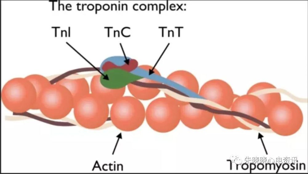 心肌的肌钙蛋白t和肌钙蛋白i具有心肌特异性,目前用于急性冠脉综合征