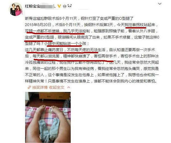花费400多万整容200次的"红粉宝宝",现状如何?与之前