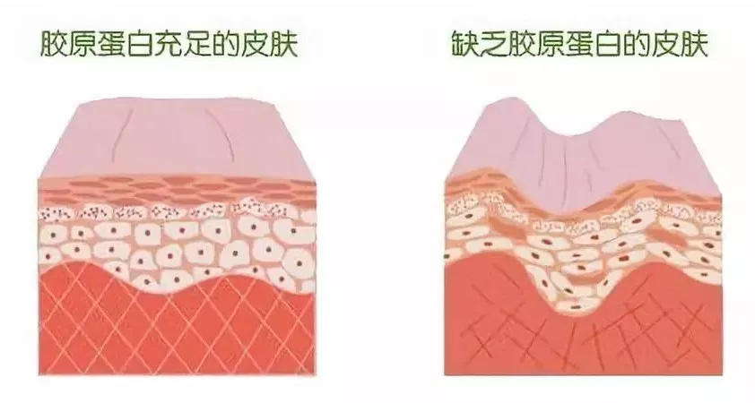 怎样去黑眼圈（怎样去黑眼圈和眼袋最有效的方法）