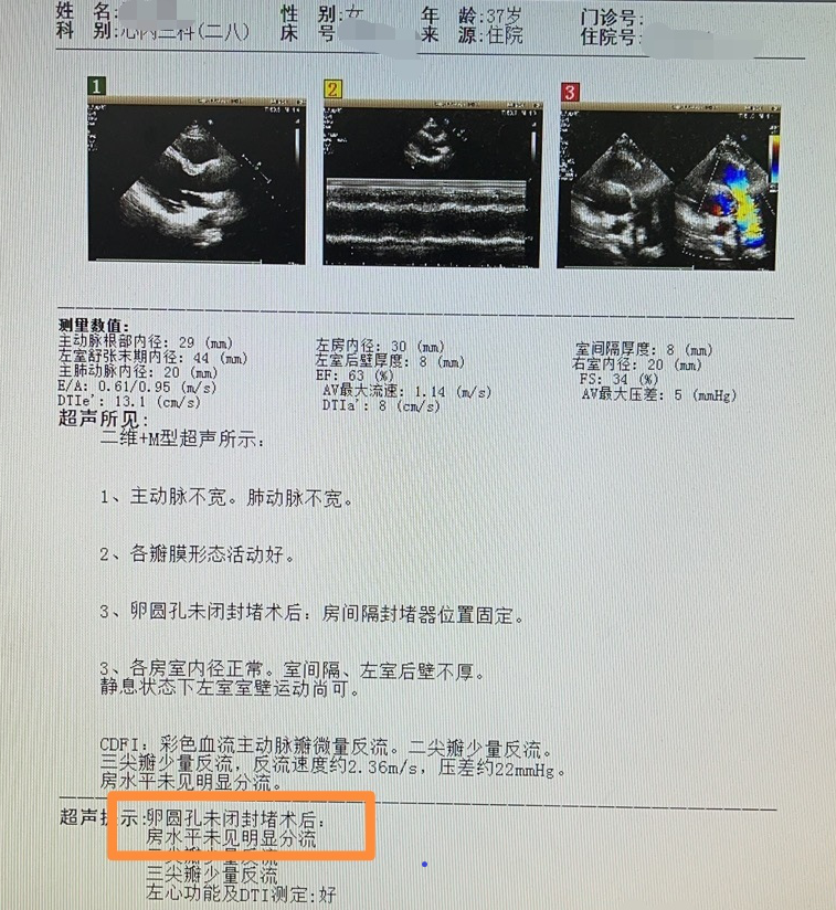 以前也没有脑梗的危险因素,这次脑梗很可能与这个卵圆孔未闭有关,结合