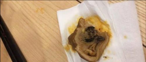 发现里面硬硬的,仔细一看发现肥肠中有黑色的粪便,这让他感到非常恶心