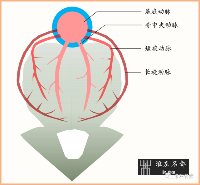 图解脑桥梗死,豆纹动脉梗死机制|解剖和示意图