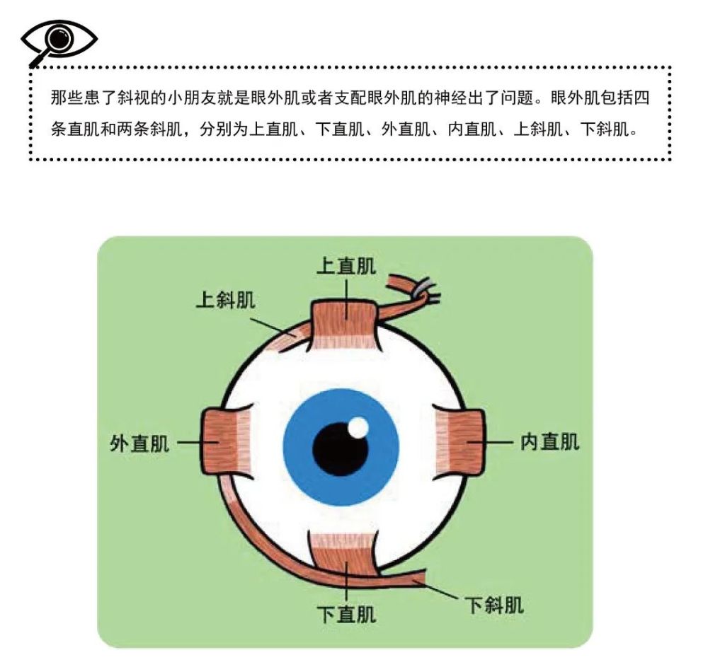 爱眼随声听|顽皮的眼外肌弟弟