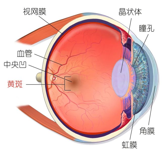 那要小心这个病|黄斑|黄斑变性
