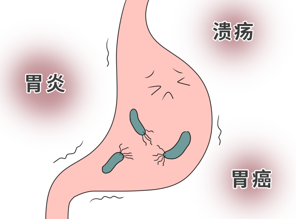 传播幽门螺杆菌,全在这4个动作里!