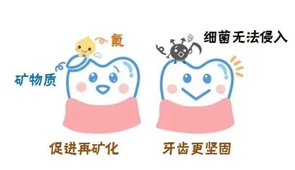 牙齿涂氟究竟是什么