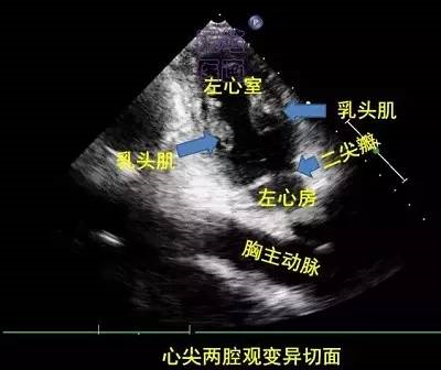 科普最萌心脏超声图谱一看就会