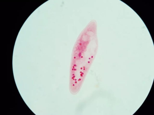 微生物的世界:看一只草履虫的科学奥秘,这些微生物知识值得学习