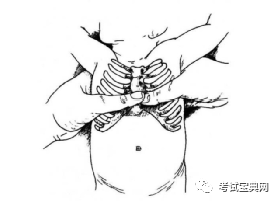 (1)新生儿或婴儿:双指按压法(图1,双手环抱拇指按压法(图2.