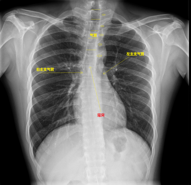 胸片解剖:实用知识大全
