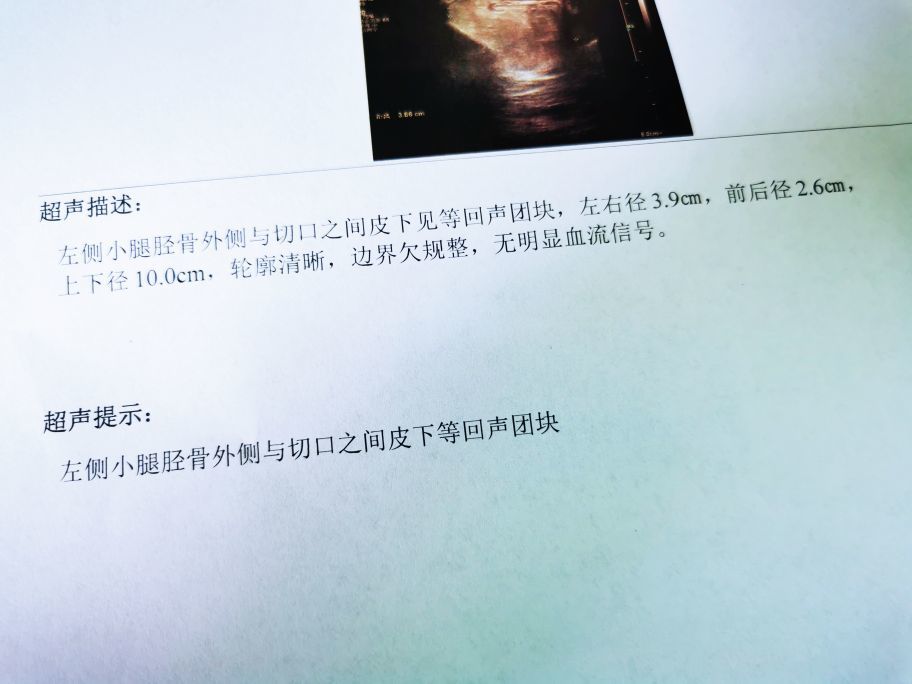 脂肪瘤与肉瘤有哪些区别,何时需要就诊呢?