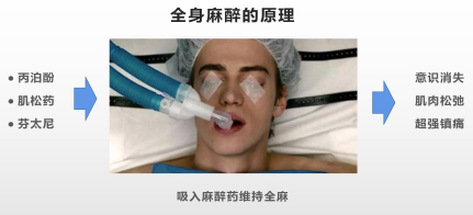 直到 1983 年生产出以脂肪乳剂为溶剂的得普利麻,丙泊酚才开始正式