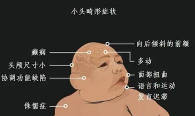 趣闻:非洲一23岁男子,爱吃香蕉长相似猴子,总被人当动物欺负