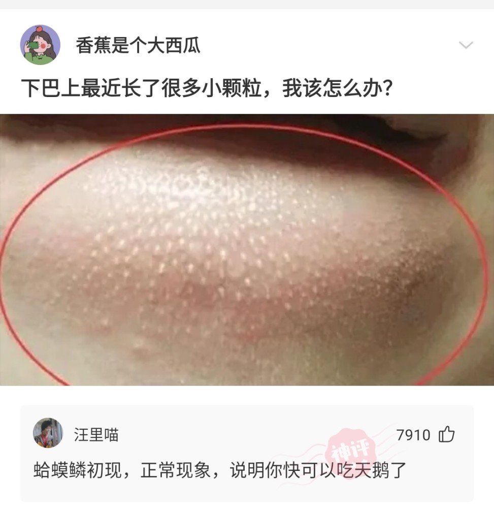 【沙雕问题7】下巴上最近长了很多小颗粒,我该怎么办?