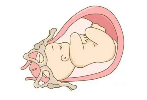 你知道,胎儿娩出也有固定的步骤吗?