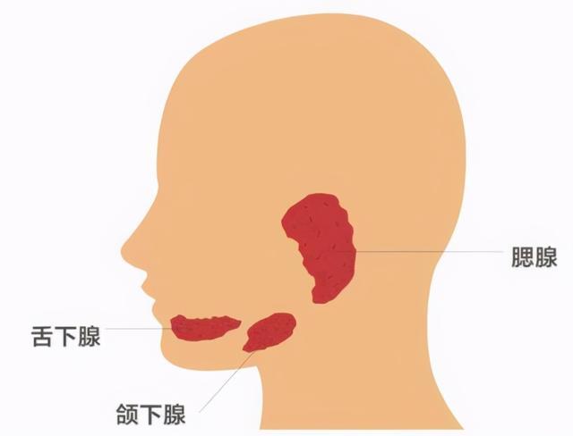 涎腺癌占涎腺癌的80,其中75%为良性,而颌下腺肿瘤中半数以上为恶性.