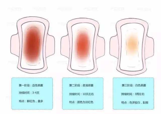 产后多久恶露会消失?