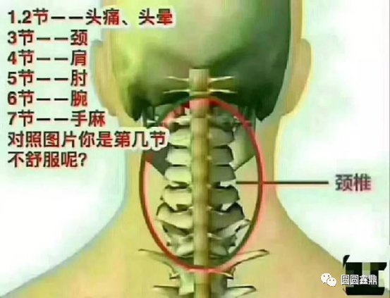 别等颈椎报废了才后悔的2个动作强化颈椎力量预防颈椎病