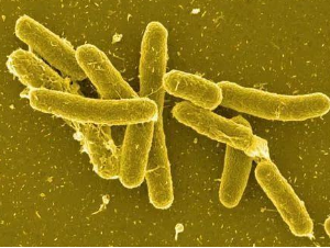 沙门氏菌属(salmonella)是一大类寄生于人类和动物肠道内,生化反应和