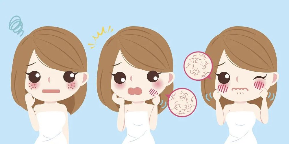 秋季皮肤病防治小妙招带你远离干燥