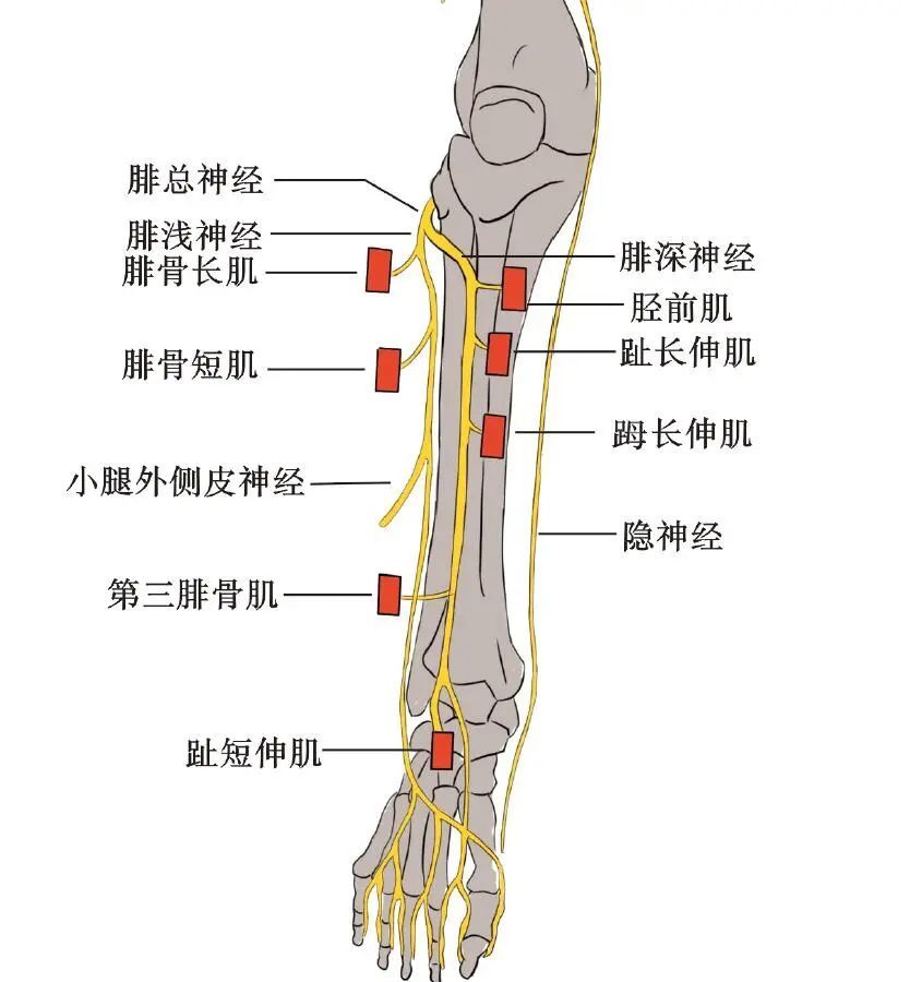 小腿疼痛的原因和治疗原则