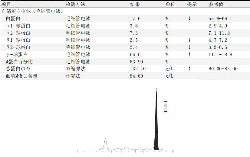 区出现m-蛋白区带,血清免疫固定电泳(图10)发现igg-κ异常单克隆条带