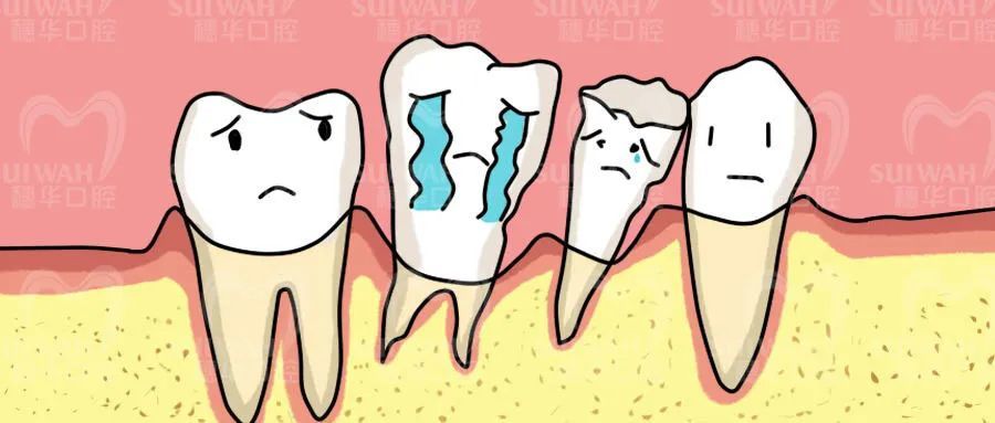 牙龈发炎怎么办（牙龈发炎怎么办快速止痛消肿止痛）