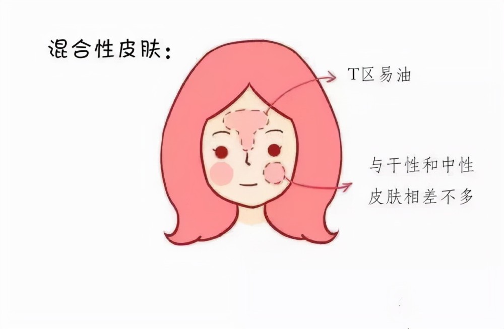 混合性皮肤