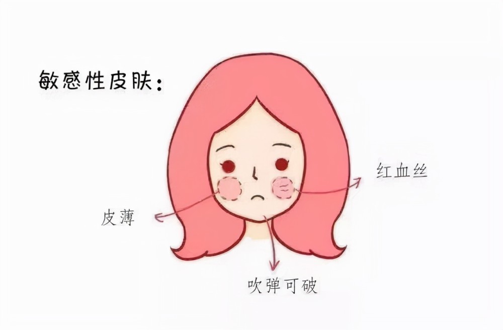 敏感性皮肤